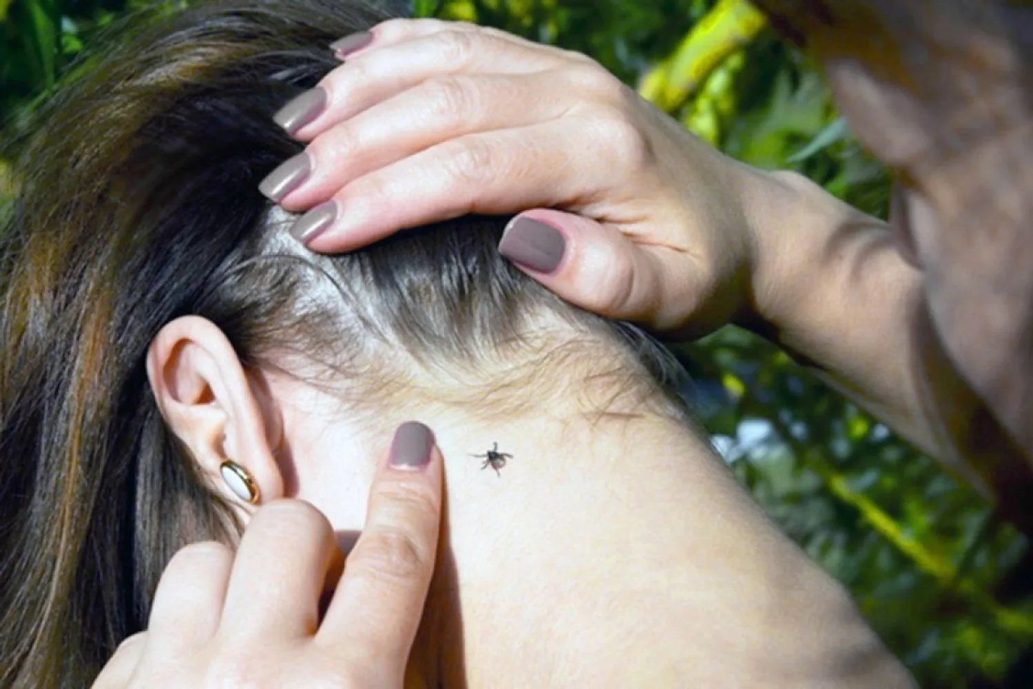 76 человек пострадали от укусов клещей в Нур-Султане