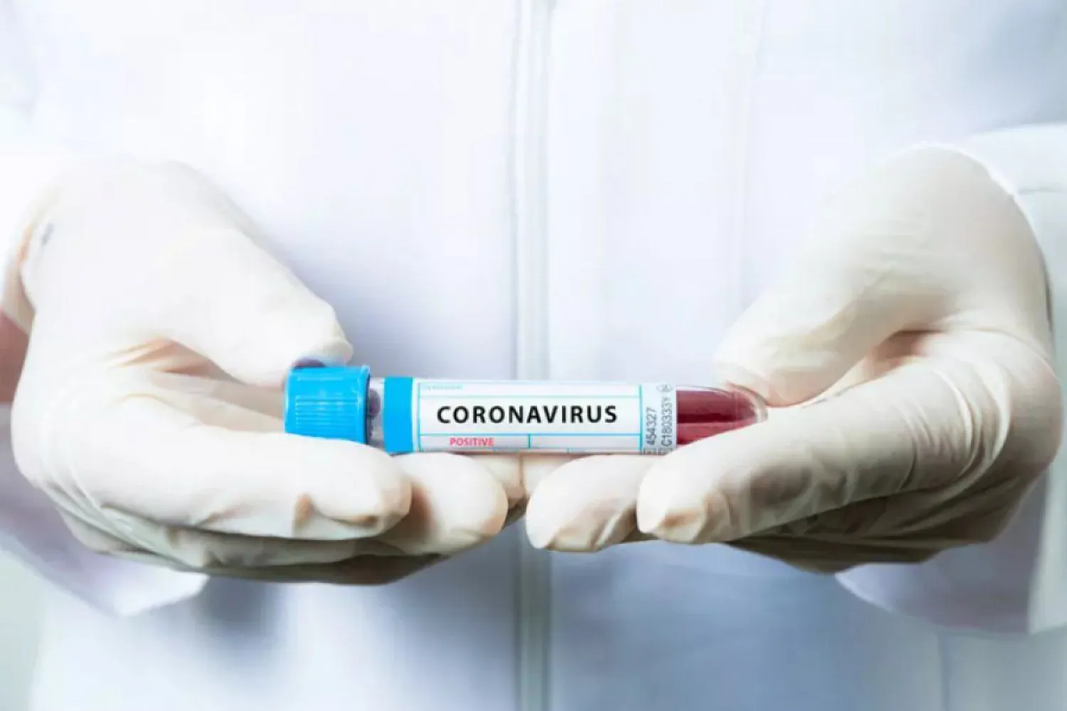 Озвучены данные по распространению COVID-19 в Казахстане на 31 июля