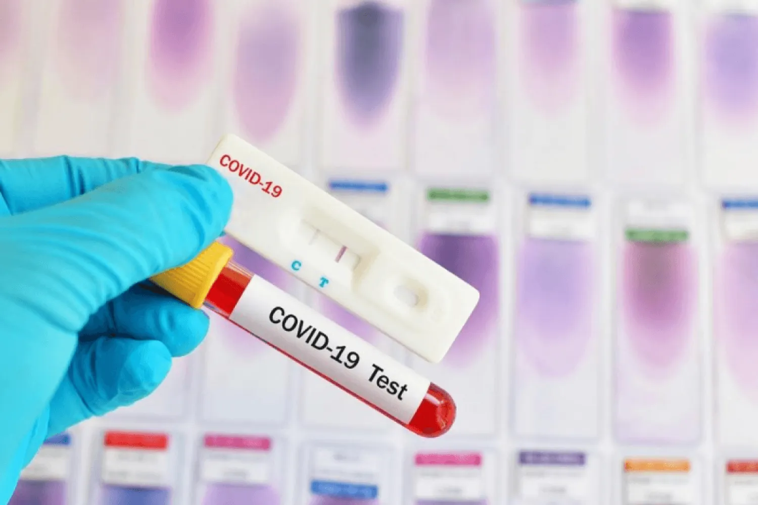 В Казахстане число заразившихся коронавирусом достигло 4 049 человек