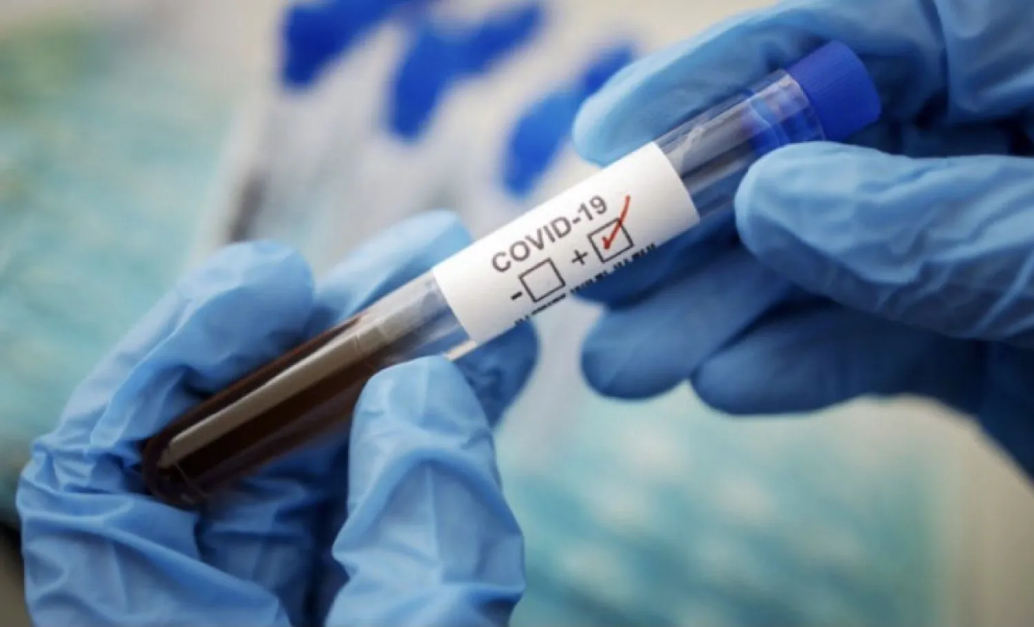 373 заболевших коронавирусом зарегистрировали в РК за сутки