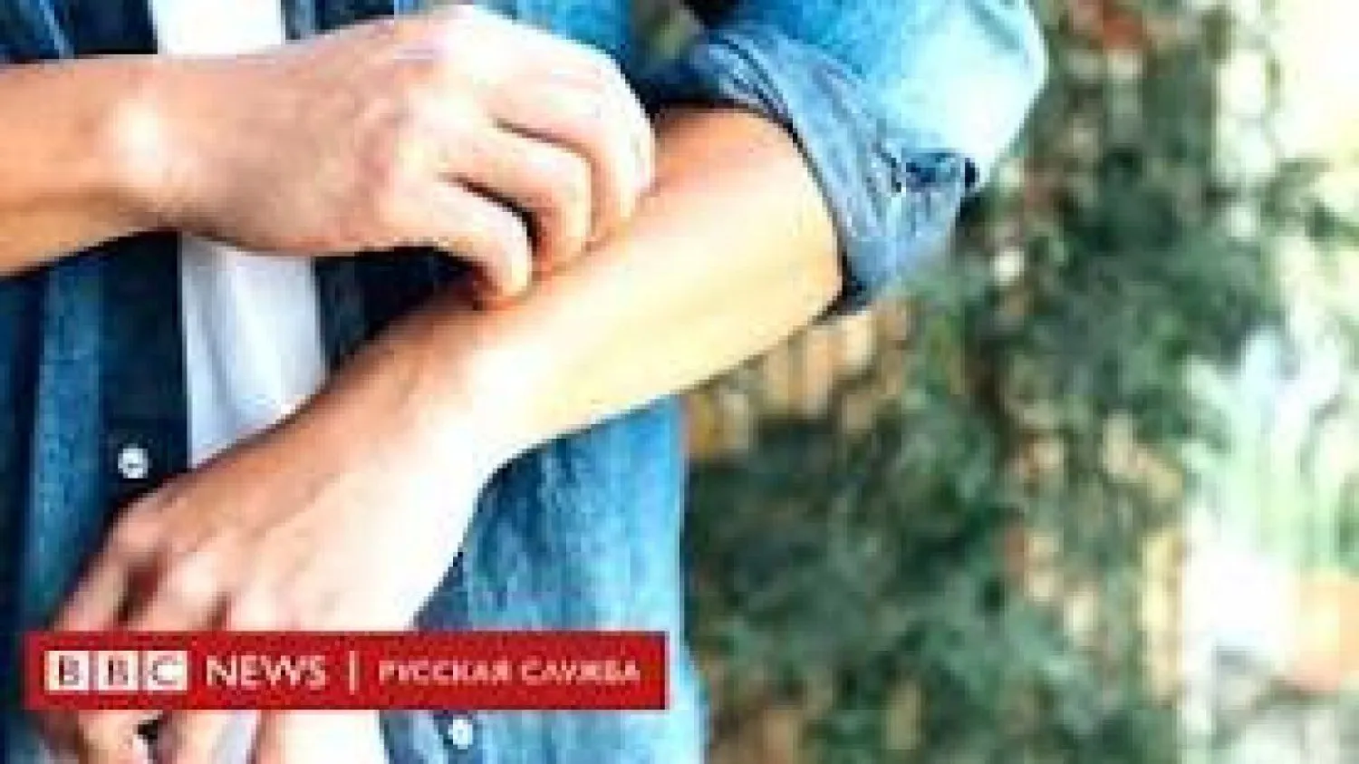 Как происходит заражение оспой обезьян